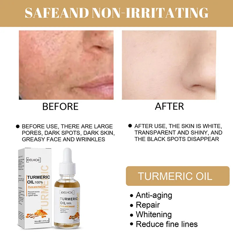 30ml Turmeric Oil: Dark Spot Corrector & Anti-Aging Serum