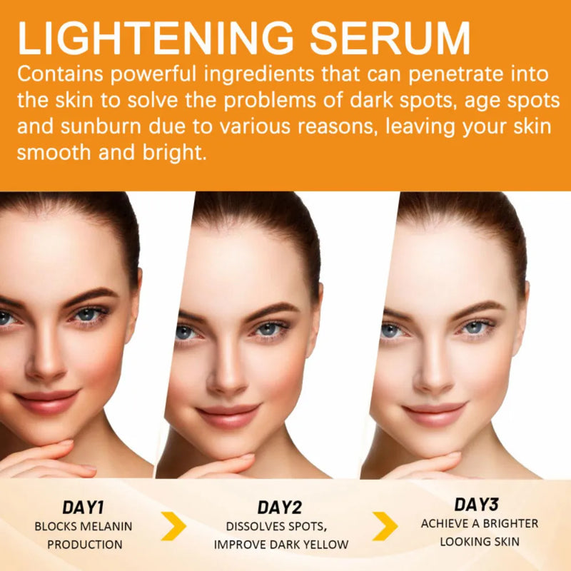 Vitamin C Whitening Facial Serum: Dark Spot Remover